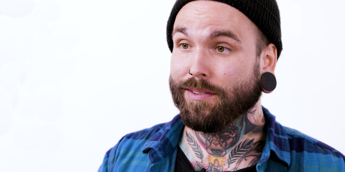 Allergie durch Tierhaare / antiallergische Augentropfen