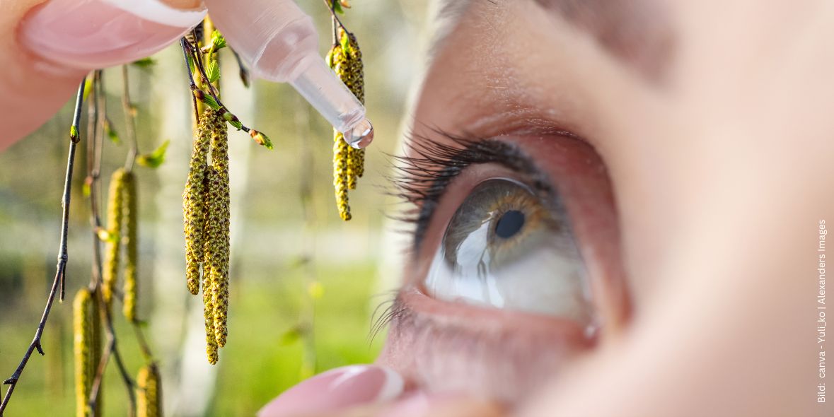 rezeptfreie-augentropfen-bei-allergie-im-test Frau tropft sich Augentropfen ins Auge Closeup und im Hintergrund Birkenpollen zum Thema Rezeptfreie Augentropfen