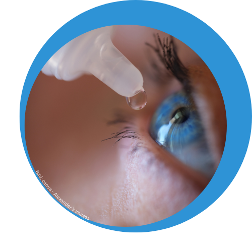 Antiallergische Augentropfen werden in ein Auge mit der Farbe blau eingetropft.