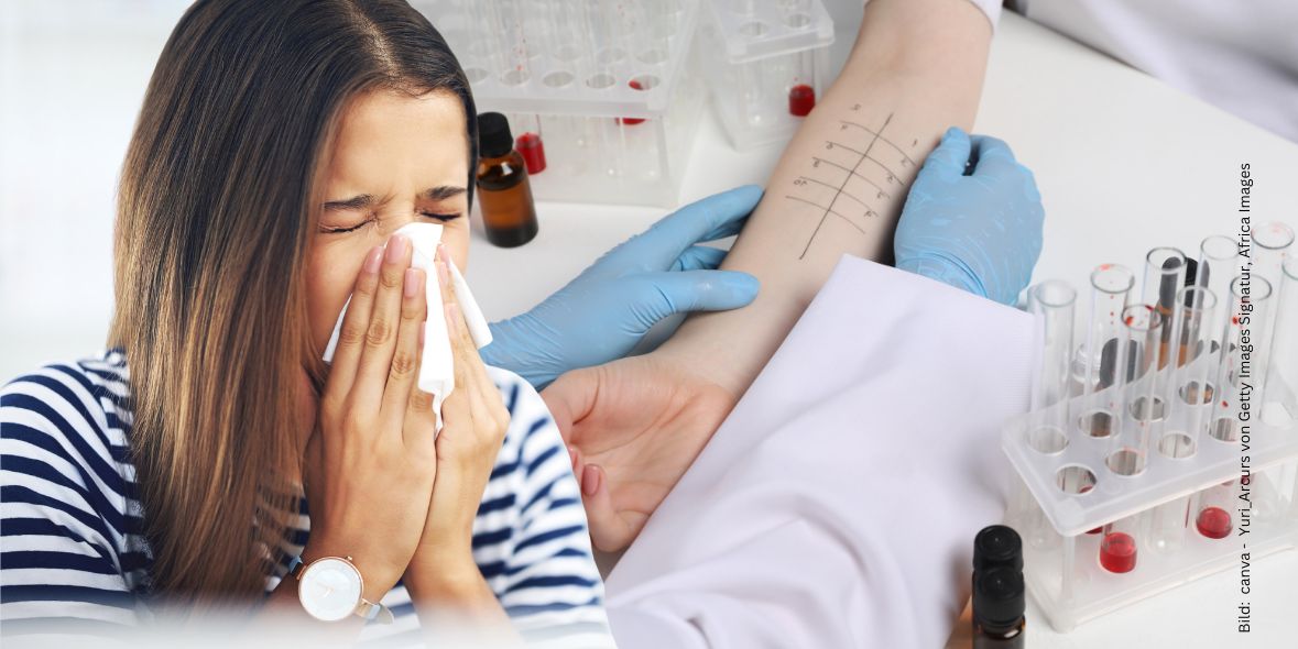 Frau mit Taschentuch im Hintergrund ein Arm, an dem ein Allergietest durchgeführt wird.
