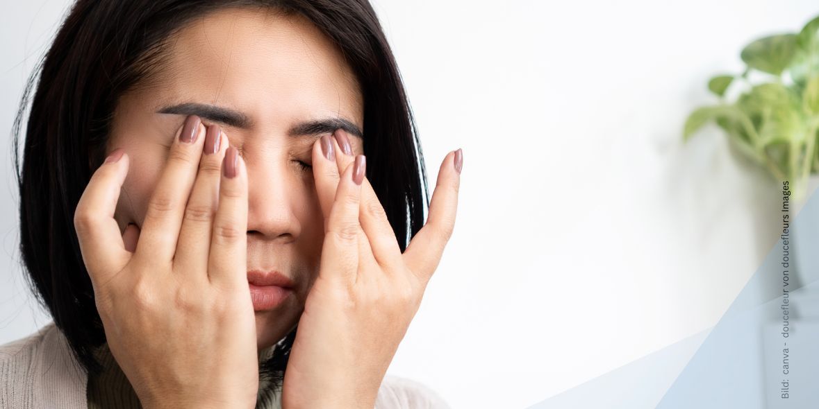 augentropfen-bei-allergie Nahaufnahme einer Frau, die sich die Augen reibt zum Thema Augentropfen bei Allergie - was bei Allergie hilft, wenn die Augen jucken und tränen